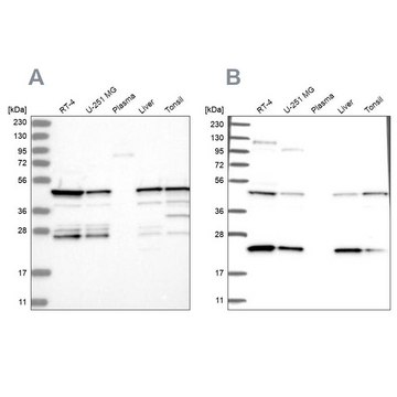 Anti-PPP1R7 antibody produced in rabbit Prestige Antibodies&#174; Powered by Atlas Antibodies, affinity isolated antibody, buffered aqueous glycerol solution