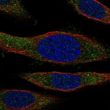 Anti-Nccrp1 Antibody Produced In Rabbit Prestige Antibodies&#174; Powered by Atlas Antibodies, affinity isolated antibody, buffered aqueous glycerol solution