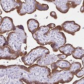 Anti-CYP19A1 antibody produced in rabbit Prestige Antibodies&#174; Powered by Atlas Antibodies, affinity isolated antibody, buffered aqueous glycerol solution