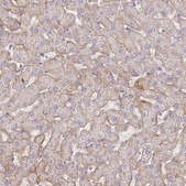 Anti-ITGA2 antibody produced in rabbit Prestige Antibodies&#174; Powered by Atlas Antibodies, affinity isolated antibody, buffered aqueous glycerol solution