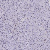 Anti-FCGR3A antibody produced in rabbit Prestige Antibodies&#174; Powered by Atlas Antibodies, affinity isolated antibody, buffered aqueous glycerol solution