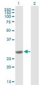 Anti-COMT antibody produced in mouse purified immunoglobulin, buffered aqueous solution