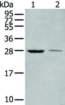 Anti-WBP1 affinity isolated antibody