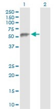 Anti-ESAM antibody produced in rabbit purified immunoglobulin, buffered aqueous solution