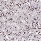 Anti-HNRNPDL antibody produced in rabbit Prestige Antibodies&#174; Powered by Atlas Antibodies, affinity isolated antibody, buffered aqueous glycerol solution