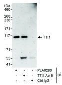 Rabbit anti-TTI1 Antibody, Affinity Purified Powered by Bethyl Laboratories, Inc.