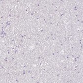 Anti-MYL4 antibody produced in rabbit Prestige Antibodies&#174; Powered by Atlas Antibodies, affinity isolated antibody, buffered aqueous glycerol solution