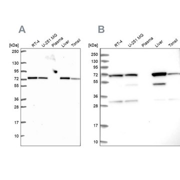 Anti-SDHA antibody produced in rabbit Prestige Antibodies&#174; Powered by Atlas Antibodies, affinity isolated antibody