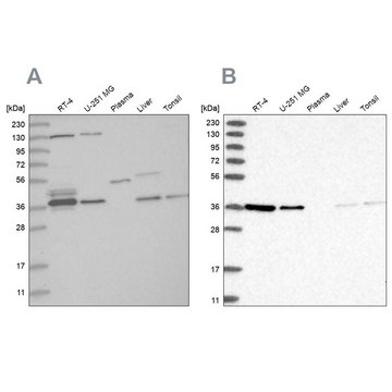 Anti-VTA1 antibody produced in rabbit Prestige Antibodies&#174; Powered by Atlas Antibodies, affinity isolated antibody, buffered aqueous glycerol solution