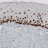 Monoclonal Anti-TP63 antibody produced in mouse Prestige Antibodies&#174; Powered by Atlas Antibodies, clone CL3748, purified immunoglobulin, buffered aqueous glycerol solution