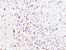 Anti-&#946;II-Tubulin/&#946;2-Tubulin Antibody, clone 1R3R9, Rabbit Monoclonal