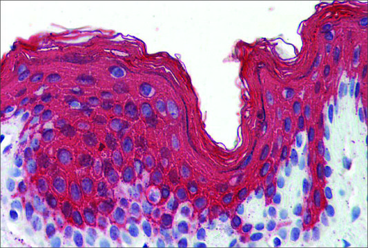 Anti-KRT1 antibody produced in rabbit affinity isolated antibody