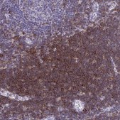 Anti-SPN antibody produced in rabbit Prestige Antibodies&#174; Powered by Atlas Antibodies, affinity isolated antibody, buffered aqueous glycerol solution