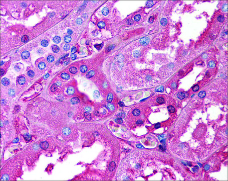 Anti-ALB (ab2) antibody produced in rabbit affinity isolated antibody