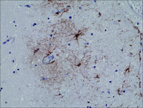 Anti-GFAP antibody, Rabbit monoclonal recombinant, expressed in HEK 293 cells, clone RM246, purified immunoglobulin