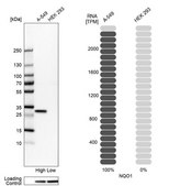 Anti-NQO1 antibody produced in rabbit Prestige Antibodies&#174; Powered by Atlas Antibodies, affinity isolated antibody, buffered aqueous glycerol solution