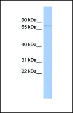 Anti-TP73 antibody produced in rabbit affinity isolated antibody