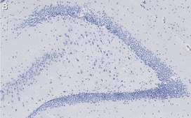 Anti-C9ORF72 (long form) Antibody, clone 1I9 ZooMAb&#174; Rabbit Monoclonal recombinant, expressed in HEK 293 cells