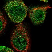 Anti-WIPI2 antibody produced in rabbit Prestige Antibodies&#174; Powered by Atlas Antibodies, affinity isolated antibody, buffered aqueous glycerol solution, Ab1