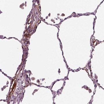 Anti-PTX3 antibody produced in rabbit Prestige Antibodies&#174; Powered by Atlas Antibodies, affinity isolated antibody, buffered aqueous glycerol solution