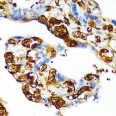 Anti-HBG1 Antibody, clone 6F1A8, Rabbit Monoclonal