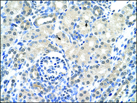 Anti-KRT17 antibody produced in rabbit affinity isolated antibody