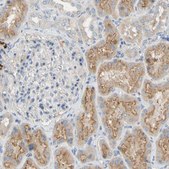 Anti-DKK3 antibody produced in rabbit Prestige Antibodies&#174; Powered by Atlas Antibodies, affinity isolated antibody, buffered aqueous glycerol solution