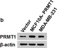 Anti-PRMT1 Antibody Upstate&#174;, from rabbit