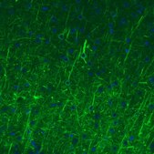 Monoclonal Anti-NEFM antibody produced in mouse Prestige Antibodies&#174; Powered by Atlas Antibodies, clone CL2678, purified immunoglobulin, buffered aqueous glycerol solution
