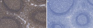 Anti-Talin-1 Antibody, clone 2F8 ZooMAb&#174; Rabbit Monoclonal recombinant, expressed in HEK 293 cells