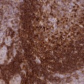 Anti-CXCR5 antibody produced in rabbit Prestige Antibodies&#174; Powered by Atlas Antibodies, affinity isolated antibody, buffered aqueous glycerol solution