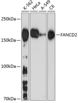 Anti-FANCD2 Antibody, clone 7U2D6, Rabbit Monoclonal