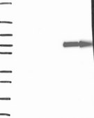 Anti-SLC28A1 antibody produced in rabbit Prestige Antibodies&#174; Powered by Atlas Antibodies, affinity isolated antibody, buffered aqueous glycerol solution