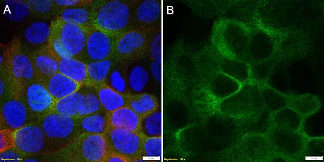Anti-MR1 Antibody, clone 1D18 ZooMAb&#174; Rabbit Monoclonal recombinant, expressed in HEK 293 cells