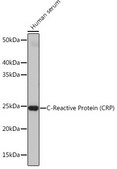 Anti-C-Reactive Protein (CRP) antibody produced in rabbit