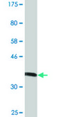 Monoclonal Anti-MGAT5 antibody produced in mouse clone 3E9, purified immunoglobulin, buffered aqueous solution