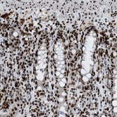 Anti-NUMA1 antibody produced in rabbit Prestige Antibodies&#174; Powered by Atlas Antibodies, affinity isolated antibody, buffered aqueous glycerol solution, Ab1