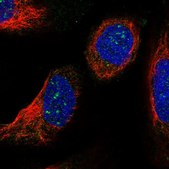 Anti-LSM7 antibody produced in rabbit Prestige Antibodies&#174; Powered by Atlas Antibodies, affinity isolated antibody, buffered aqueous glycerol solution