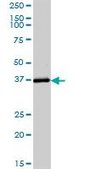Anti-ADH6 antibody produced in mouse purified immunoglobulin, buffered aqueous solution