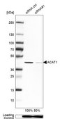 Anti-ACAT1 antibody produced in rabbit Ab1, Prestige Antibodies&#174; Powered by Atlas Antibodies, affinity isolated antibody, buffered aqueous glycerol solution