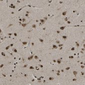 Anti-SPEN antibody produced in rabbit Prestige Antibodies&#174; Powered by Atlas Antibodies, affinity isolated antibody, buffered aqueous glycerol solution