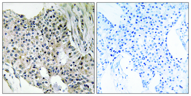 Anti-UEVLD antibody produced in rabbit affinity isolated antibody