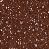 Monoclonal Anti-CD47 antibody produced in mouse Prestige Antibodies&#174; Powered by Atlas Antibodies, clone CL6913, purified immunoglobulin, buffered aqueous glycerol solution