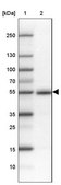 Anti-FAM149B1 antibody produced in rabbit Prestige Antibodies&#174; Powered by Atlas Antibodies, affinity isolated antibody, buffered aqueous glycerol solution