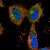 Anti-KLHL20 antibody produced in rabbit Prestige Antibodies&#174; Powered by Atlas Antibodies, affinity isolated antibody, buffered aqueous glycerol solution