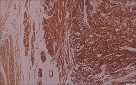 h-Caldesmon (hHCD) Mouse Monoclonal Antibody