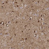 Anti-PHGDH antibody produced in rabbit Prestige Antibodies&#174; Powered by Atlas Antibodies, affinity isolated antibody, buffered aqueous glycerol solution, Ab2