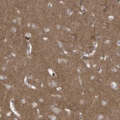 Anti-P2RX7 antibody produced in rabbit Prestige Antibodies&#174; Powered by Atlas Antibodies, affinity isolated antibody, buffered aqueous glycerol solution