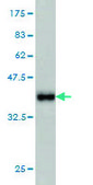 Monoclonal Anti-IDH2 antibody produced in mouse clone 5F11, purified immunoglobulin, buffered aqueous solution