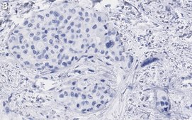 Anti-Glypican-1 Antibody, clone 1J4, ZooMAb&#174; Rabbit Monoclonal recombinant, expressed in HEK 293 cells